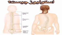 اسکولیوز فیزیوتراپی۰۹۱۲۲۶۵۵۶۴۸طرف قرارداد بیمه تامین اجتماعی،سلامت ایرانیان