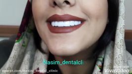 دندانپزشک زیبایی ترمیمی کامپوزیت لمینت