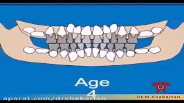روند رویش دندان های شیری دائمی در کودکان