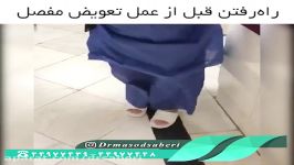 نتیجه عمل تعویض مفصل مصنوعی  دکتر مسعود صابری