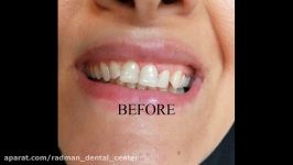 متخصص دندانپزشکی زیبایی در کرج رادمان