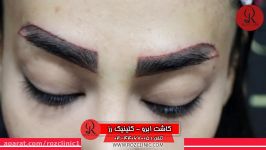 کاشت ابرو  فیلم کاشت ابرو  کلینیک پوست مو رز  شماره101