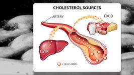 Low Carb Keto What about Cholesterol