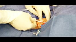 Pulmonary Artery Catheterization