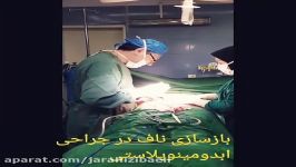 جراحی شکم  ابدومینوپلاستی بازسازی ناف توسط دکتر سینا غیاثی حافظی