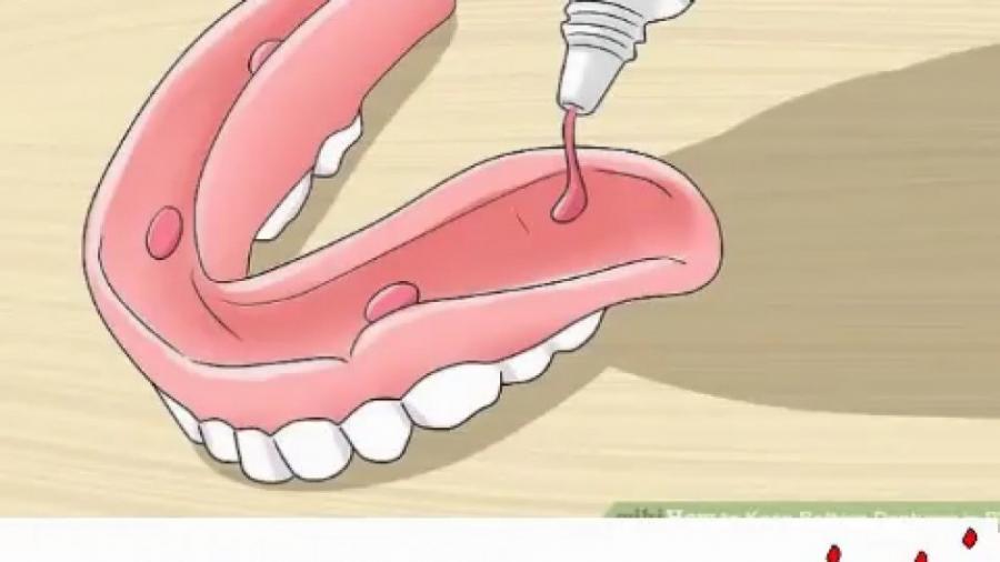 انیمیشن روش استفاده چسب دندان مصنوعی