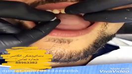 بهترین دندانپزشک زیبایی ترمیمی د رتهران  بهترین کلینیک دندانپزشکی در تهران