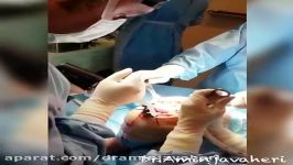 جراحی تعویض کامل مفصل زانو توسط دکتر علیرضا امین جواهری