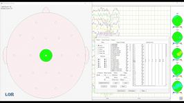 لورتا نوروفیدبک  Loreta NeuroFeedback