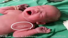 نوزاد متولد شده توسط دکتر لیلا تدین
