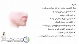 کبد چرب پیشگیری مراقبت Fatty Liver