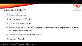 Assessment of hemodynamic parameters of Left Main Pre and Post PCI