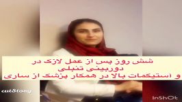 ویدیوفیلم نتایج عالی عمل لازک چشم آستیگمات وباتنبلی درهمکار پزشک توسط دکترمهرداد