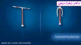 نحوه کار گذاشتن IUD  دکتر زهرا سیفی