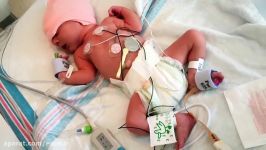 حسگرهای بی سیم انعطاف پذیر به عنوان ردیاب سلامت نوزادان نارس