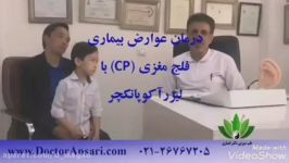 درمان عوارض فلج مغزی CP لیزرآکوپانکچر قبل درمان، دکتر عباس انصاری