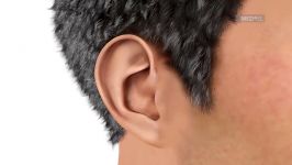 ایمپلنت های Cochlear چگونه کار میکنند؟