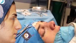 اتاق عمل جراحی بینی  بعد جراحی بینی