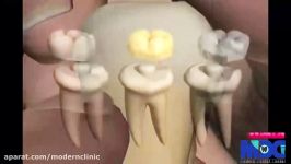 روکش دندان به جهت زیبایی کلینیک دندانپزشکی مدرن