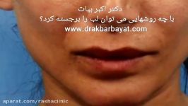 جراحی زیبایی لب توسط باسابقه دار ترین تیم مبدع زیبایی های لب در تهران
