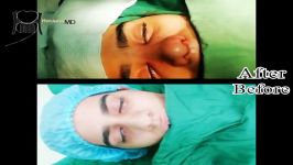اتاق عمل جراحی بینی  جراحی بینی شیراز