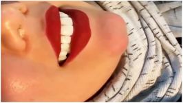 فیلم کامپوزیت دندان جلویی در کلینیک دندانپزشکی کوروش