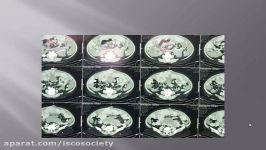 Indications out e of CRS+HIPEC for carcinomatosis