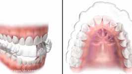 ارتودنسی نامرئی دکتر قریشی