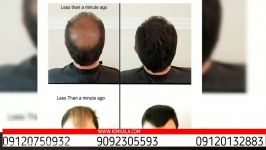 اسپری پرپشت کننده مو fh پرشت کننده مو بهترین روش پرپشت کردن مو 09120132883