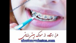 از مسواک بین دندانی چگونه استفاده کنیم؟