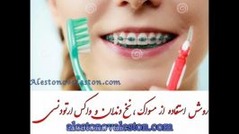 روش استفاده صحیح مسواک، نخ دندان واکس ارتودنسی