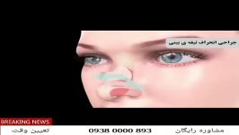 انیمیشن عمل انحراف تیغه بینی، جراحی بینی مشهد، دکتر حسین حامدی
