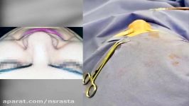 جراحی بینی چقدر استرس زاست www.dr rasta.com