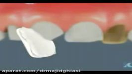 زیبایی دندان دکترمجیدقیاسیدندانپزشک زیبایی مشهد