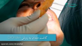 بهترین متخصص ایمپلنت دندان در اصفهان به روش DIOnavi