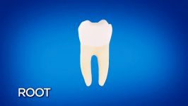 Root Canal Treatment Step by Step