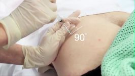 Intramuscular Injection