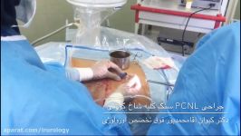 عمل جراحی سنگ کلیه به روش PCNL