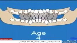 مراحل رشد تکامل دندان انسان