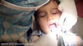 دندانپزشکی کودکان کلینیک تخصصی درسان در غرب تهران  یک جلسه درمان کودک