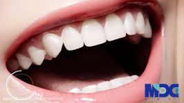 تفاوت لمینیت کامپوزیت کلینیک دندانپزشکی مدرن