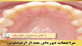 مراجعات دوره ای بعد ارتودنسی  دکتر داودیان