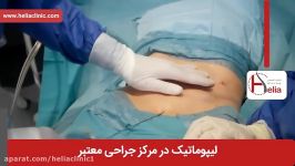 لیپوماتیک  فیلم لیپوماتیک  کلینیک پوست مو هلیا  شماره 3