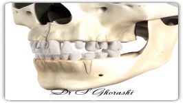 رویش دندان ها  دکتر سعید قریشی