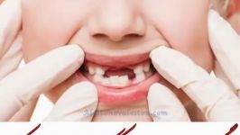 چگونه آبسه دندان لثه کودکان را درمان کنیم؟