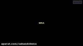 ام آر آنژیوگرافی یا MRA چیست؟