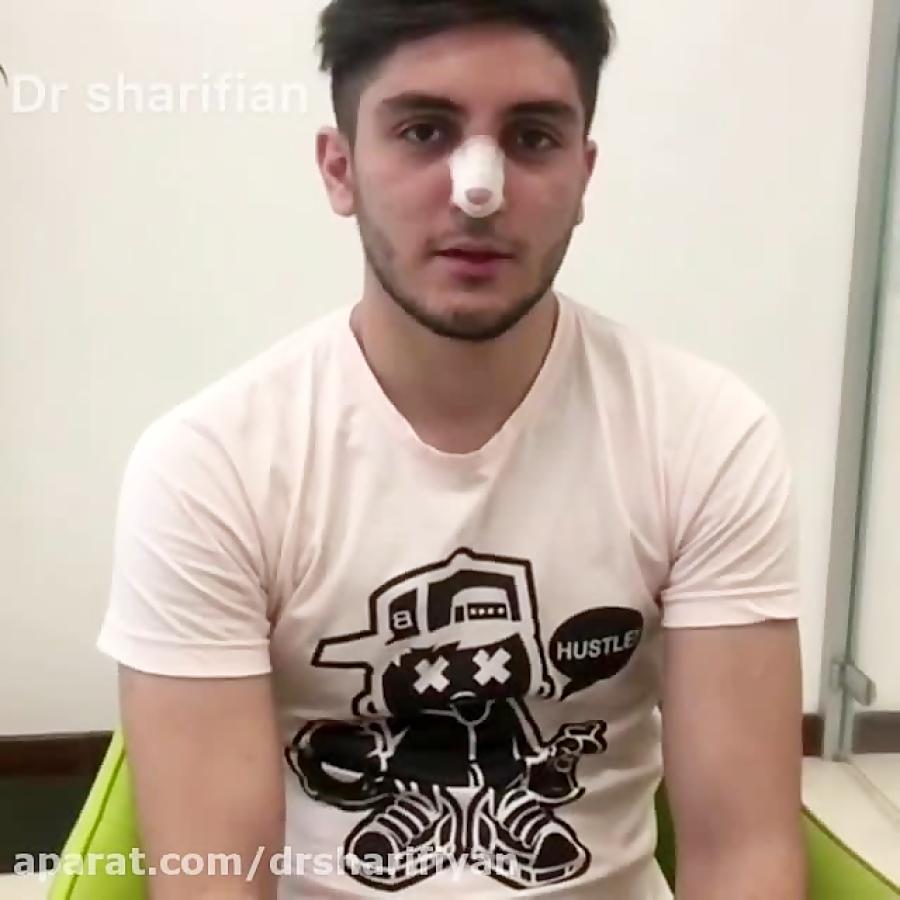 اصلاح انحراف تیغه وسط بینی جراحی زیبایی بینی  دکتر حمید شریفیان
