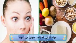 مواد غذایی باعث جوش می شوند