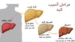 این علائم نشان میدهد کبد شما خوب کار نمیکند