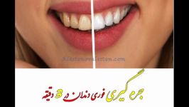 جرم گیری گیاهی خانگی دندان در خانه در کمتر 3 دقیقه